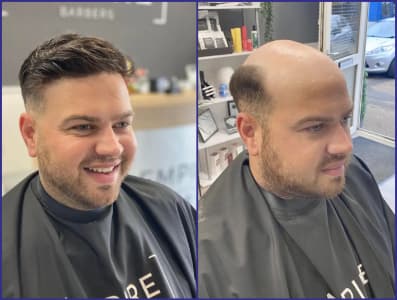 Kipling Hair Systems 